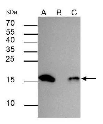 Immunoprecipitation: HIST1H3A [ac Lys18] Antibody [NBP2-43535]